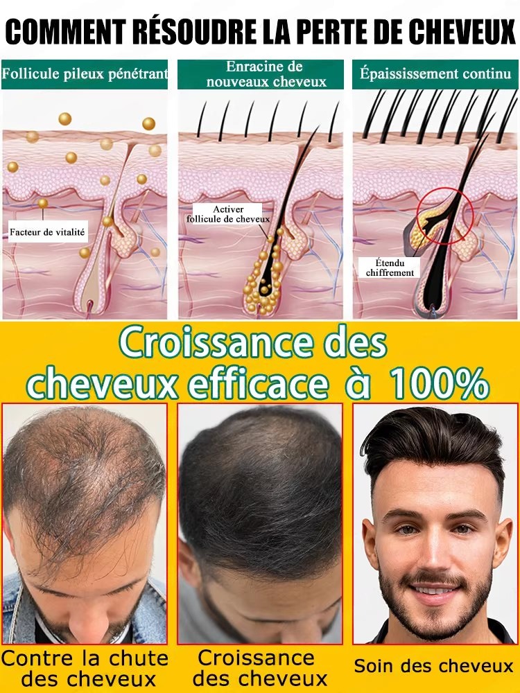 Dagelijkse gember-huidverzorgi - Hair Care For Hair Fall recensie en prijs