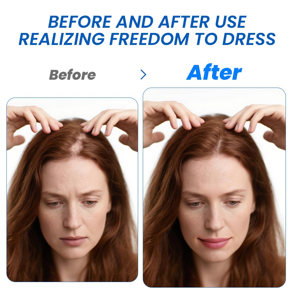 Alopecia Haargroei Spray Sopho - Hair Care Spray recensie en prijs