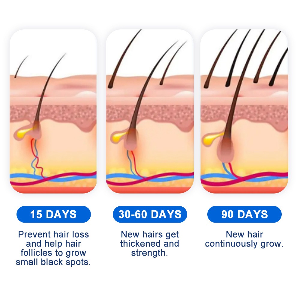 Alopecia Haargroei Spray Sopho - Hair Care Spray recensie en prijs