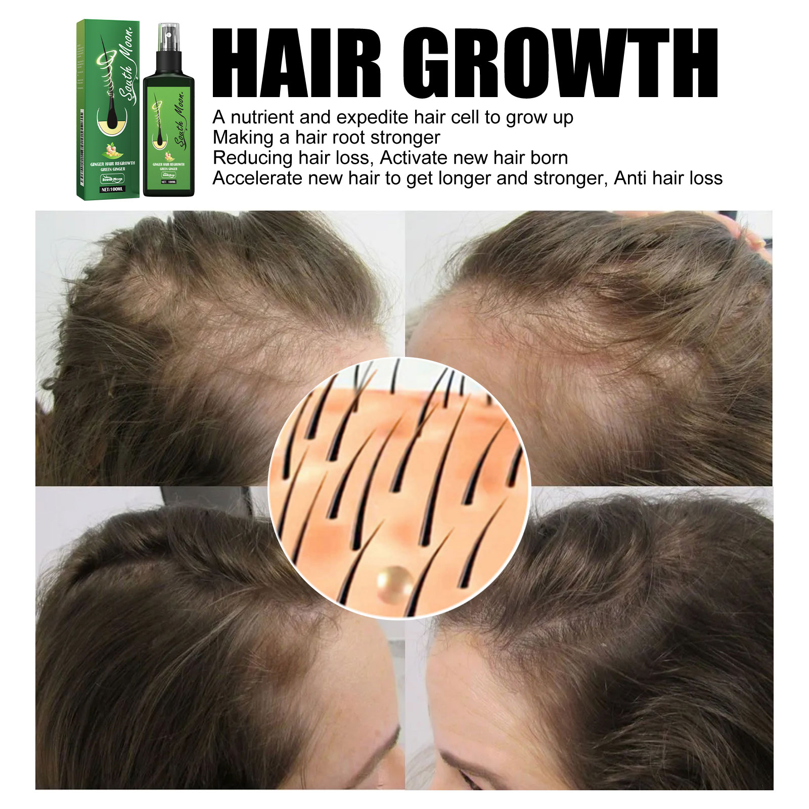 Ginger Hair Density Serum Spra - Hair Care For Hair Fall recensie en prijs